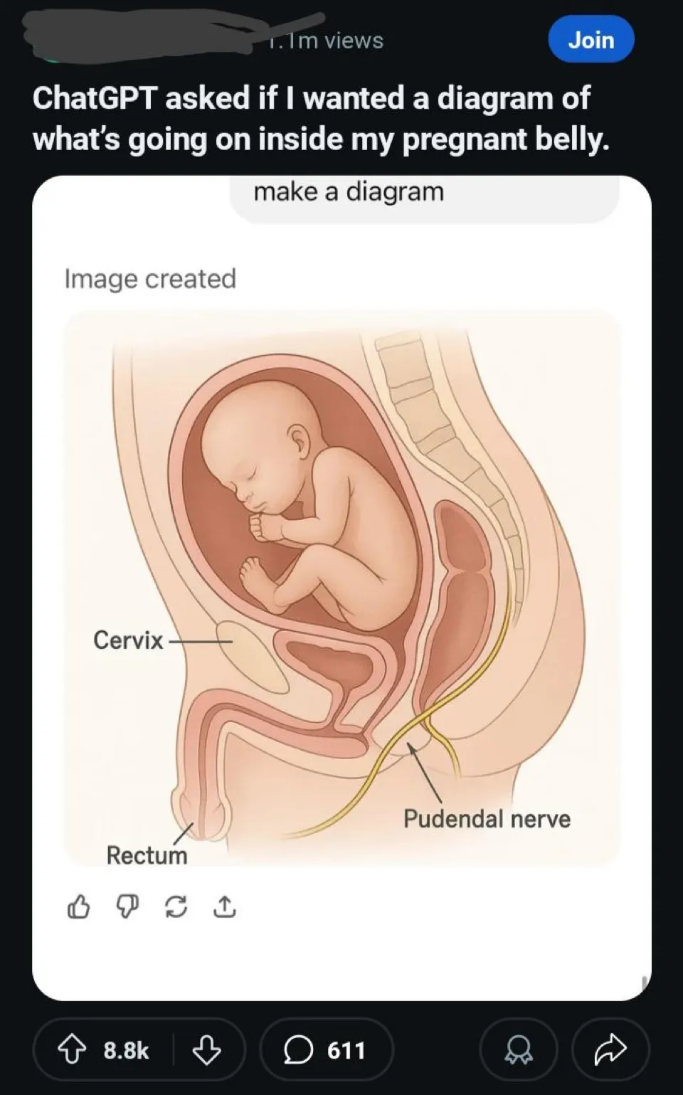 AI generiertes Bild eines Fötus in einem männlichen Bauch